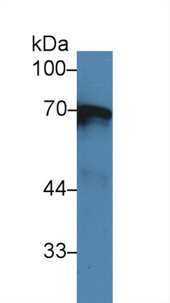 14262