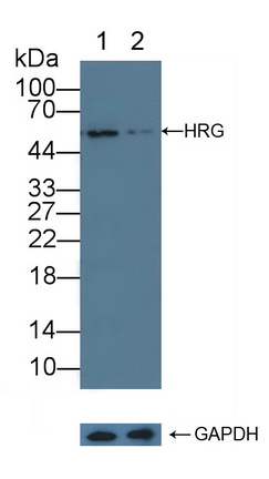 12218