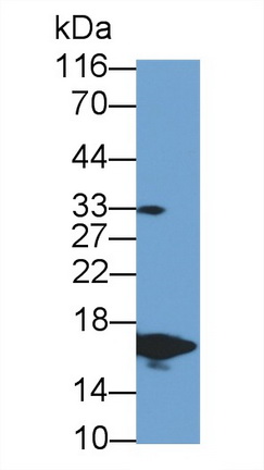 36148