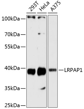 A13026, вестерн-блоттинг, различные лизаты (5502)