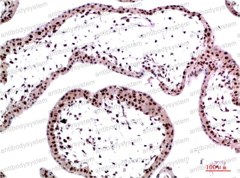 Валидация AntibodySystem RHG43407