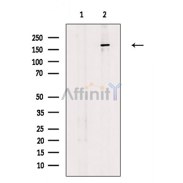 Валидация Affinity DF3374 - 14255
