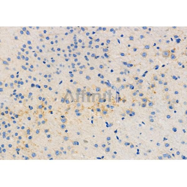 Валидация Affinity DF6353 - 17701