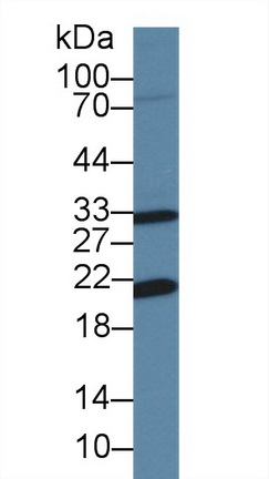 14520