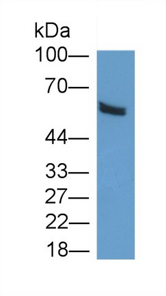 21398