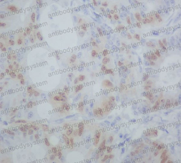 Валидация AntibodySystem RHD38202 (1541)