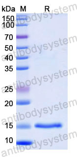 Валидация SDS-PAGE - AntibodySystem RHD49301