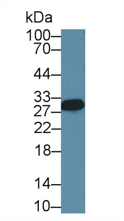14199