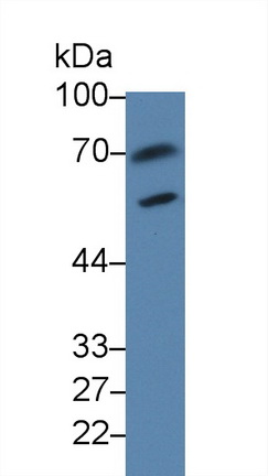 14228
