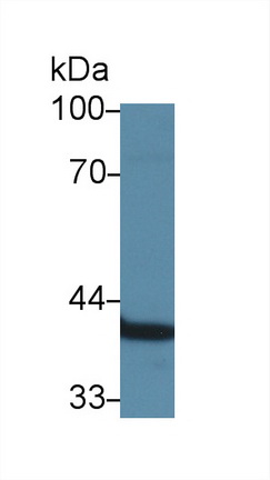 14148