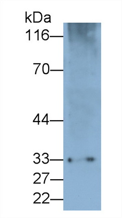 52665