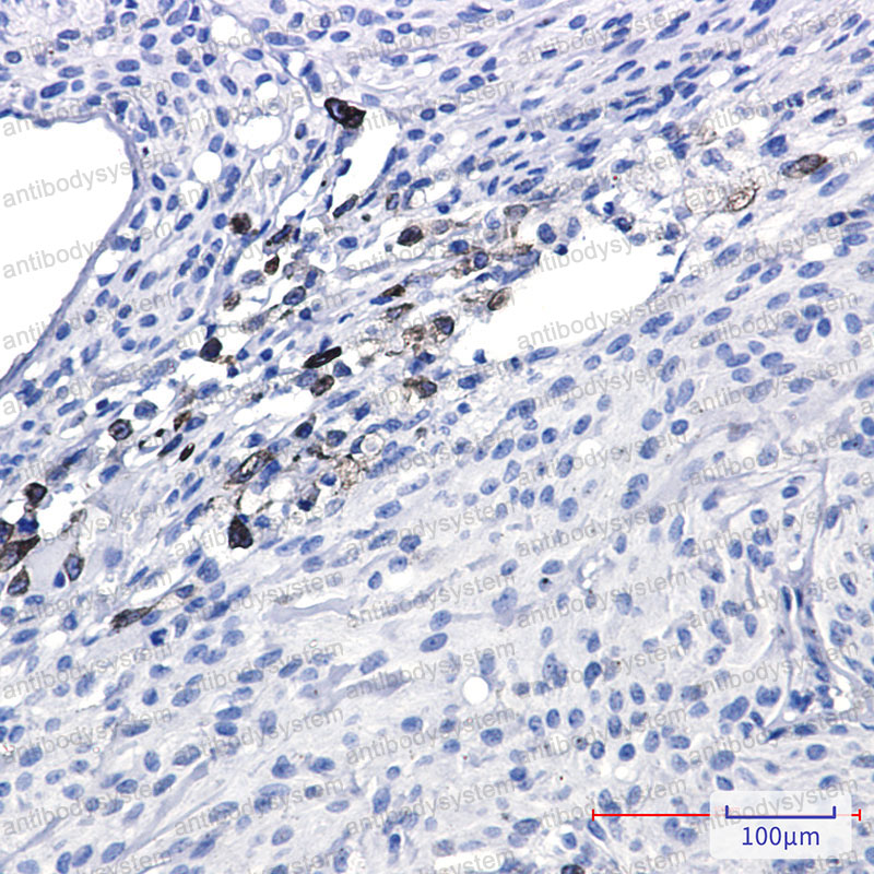 Валидация AntibodySystem RHH25901