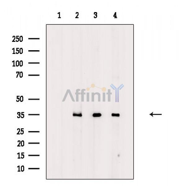 Валидация Affinity DF8691 - 20672