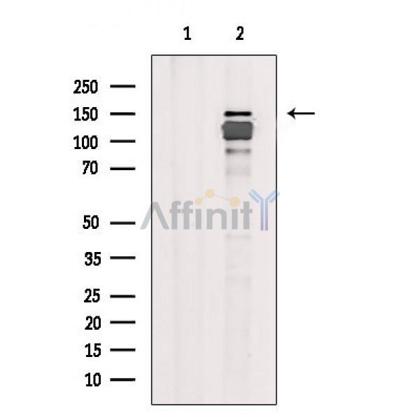 Валидация Affinity AF6518 - 3847