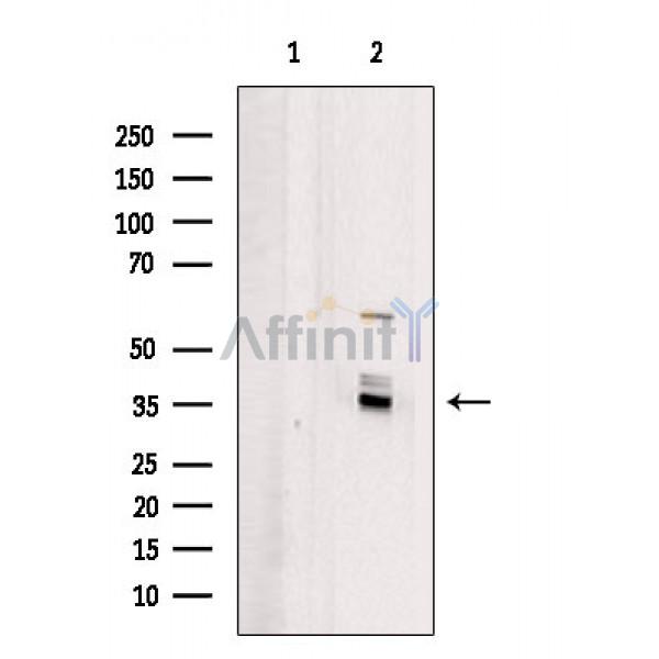Валидация Affinity DF5098 - 17028