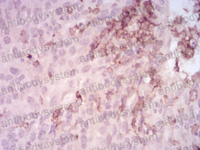 Валидация AntibodySystem RHE75503 (2311)
