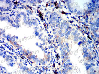 Валидация AntibodySystem RHN96401