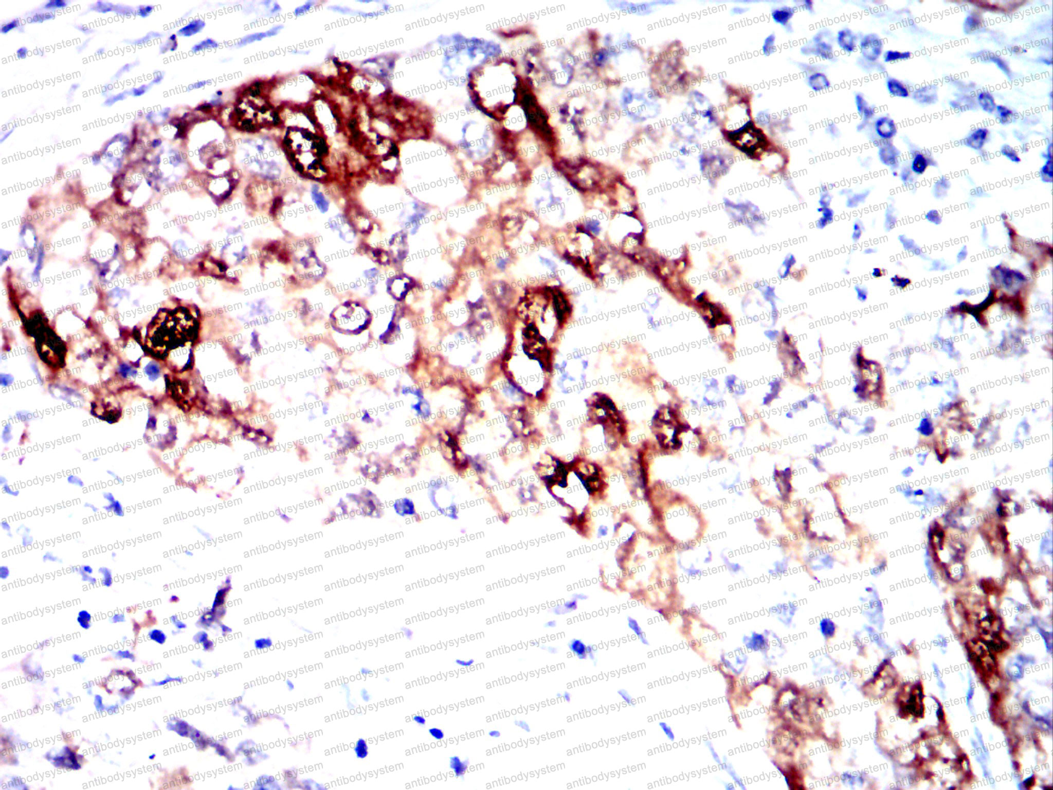 Валидация AntibodySystem RHG02903 (2799)