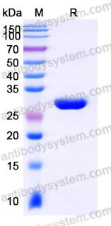 YHJ91502, SDS-PAGE
