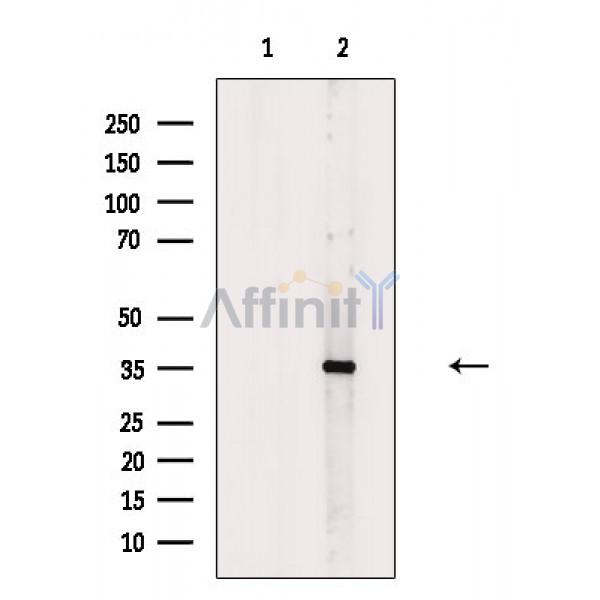Валидация Affinity DF8693 - 20675