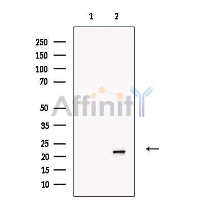 Валидация Affinity DF13356 - 8571