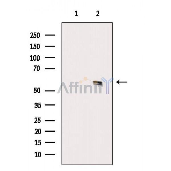Валидация Affinity DF2557 - 13225