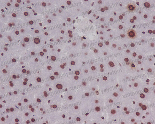 Валидация AntibodySystem RHF62714