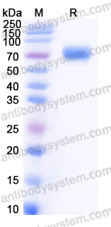 EHC02201, SDS-PAGE