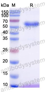 Валидация SDS-PAGE - AntibodySystem DHD72802