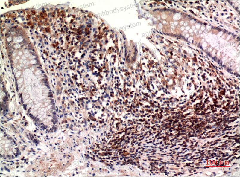 Валидация AntibodySystem RHN94104 (3977)