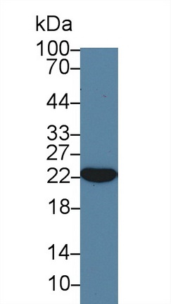 13995