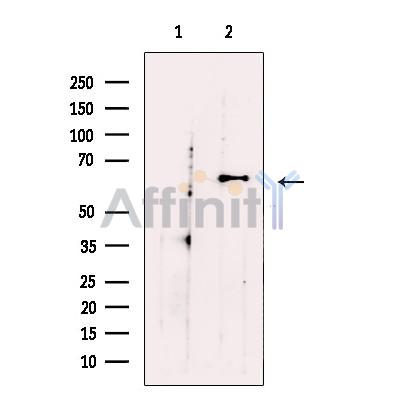Валидация Affinity DF13374 - 8615