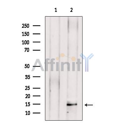 Валидация Affinity DF13538 - 8962