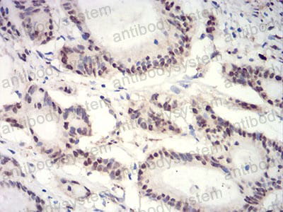 Валидация AntibodySystem RHJ11903