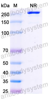Валидация SDS-PAGE - AntibodySystem RHJ92601
