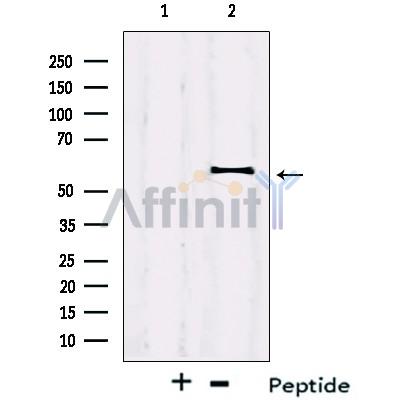 Валидация Affinity DF13096 - 7984