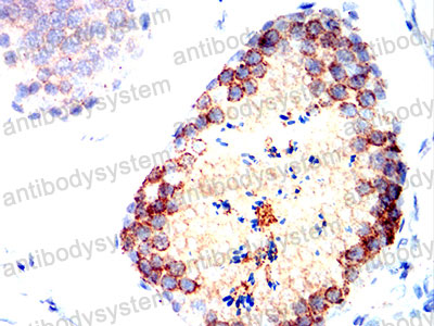Валидация AntibodySystem RHE35402