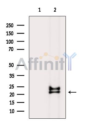 Валидация Affinity DF15302 - 11599