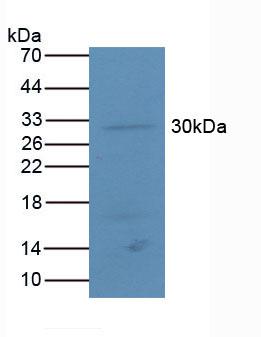5925