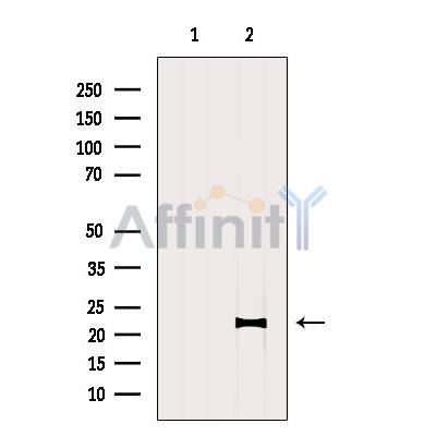Валидация Affinity DF6630 - 18097