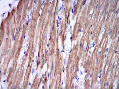 Валидация AntibodySystem RHE61802 (2239)