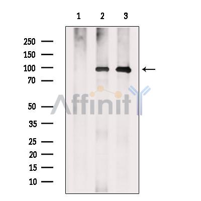 Валидация Affinity DF13656 - 9215