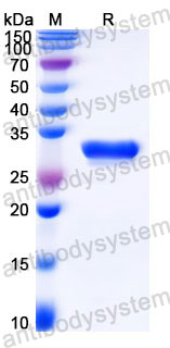 EHC40302, SDS-PAGE