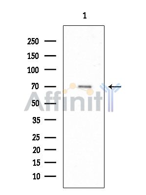 Валидация Affinity DF15020 - 11230