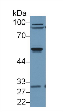 9379