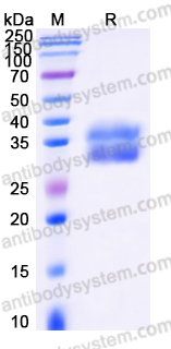 EHJ78203, SDS-PAGE