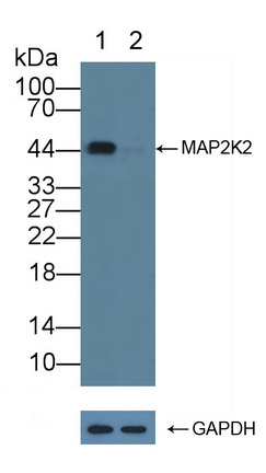 12284