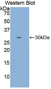 52147