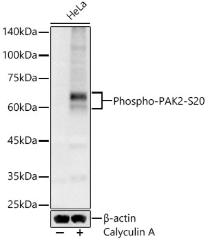 AP0803, вестерн-блоттинг, лизат клеток HeLa (27856)
