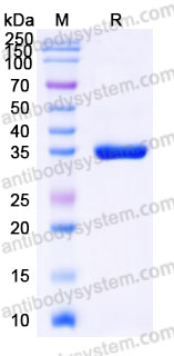 AHG17902, SDS-PAGE